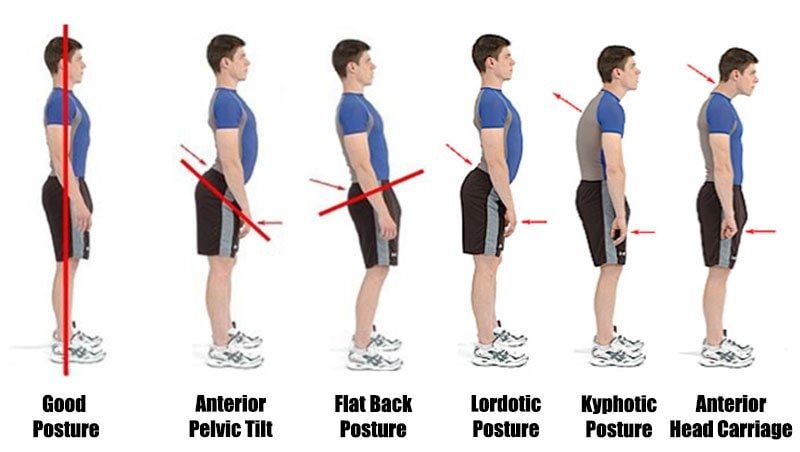 Posture and The Mark: The Foundation of Gymnastics